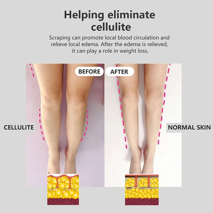 Fashion Intelligent Electric Gua Sha Instrument