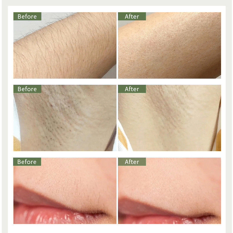 Laser Hair Removal Machine For Ladies&